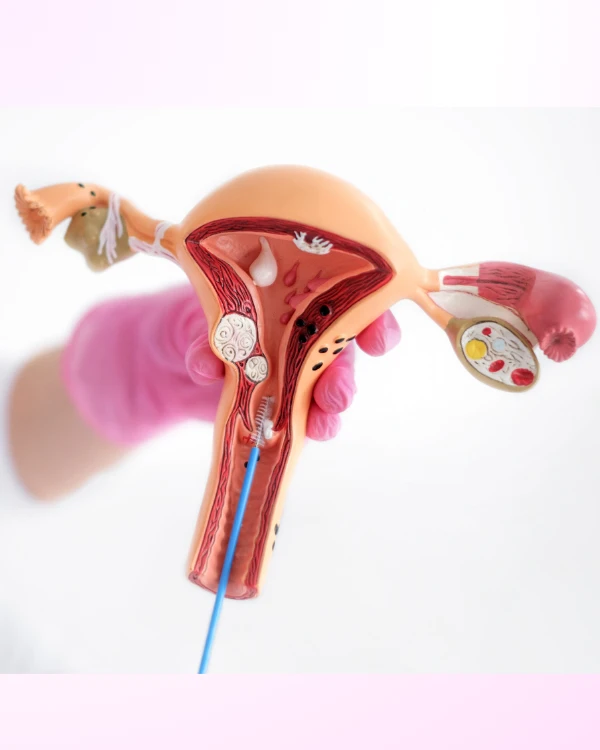 Best Hysteroscopy in Jubilee Hills – Dr. Jasmin Rath