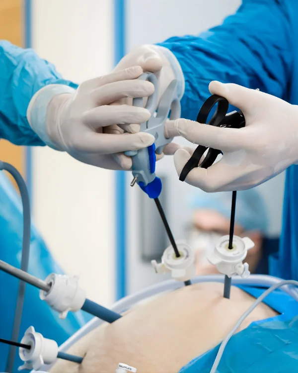 Best Laparoscopic Gynecological Surgery in Jubilee Hills – Dr. Jasmin Rath