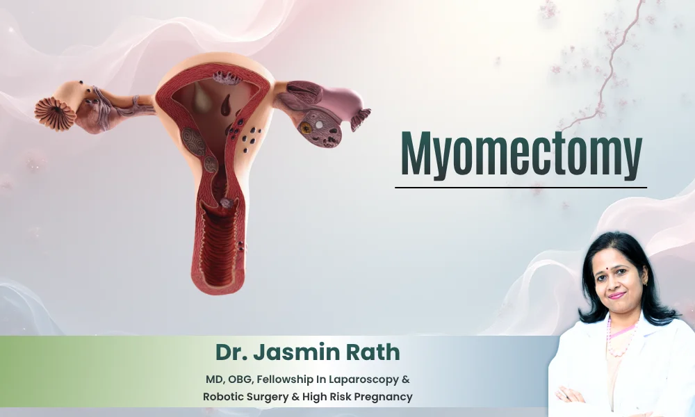 Best Myomectomy Services in Jubilee Hills – Dr. Jasmin Rath